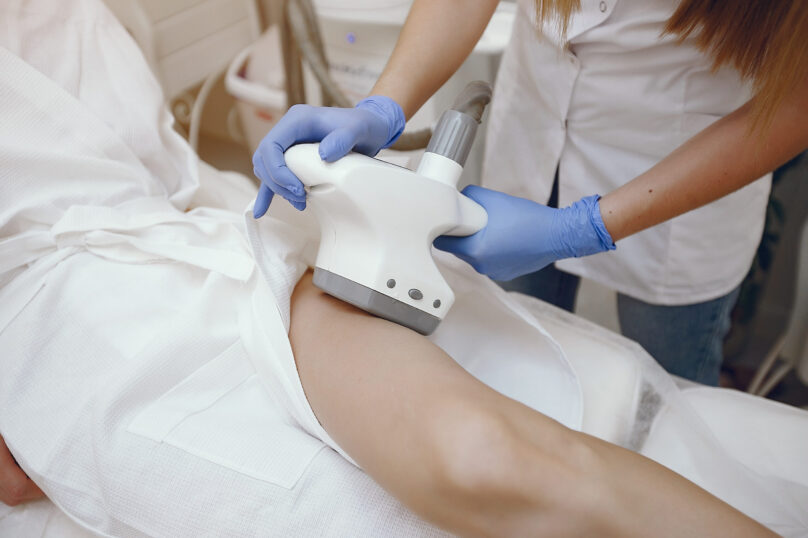 lipolaser
