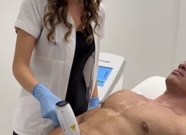 epilazione laser chic estetica