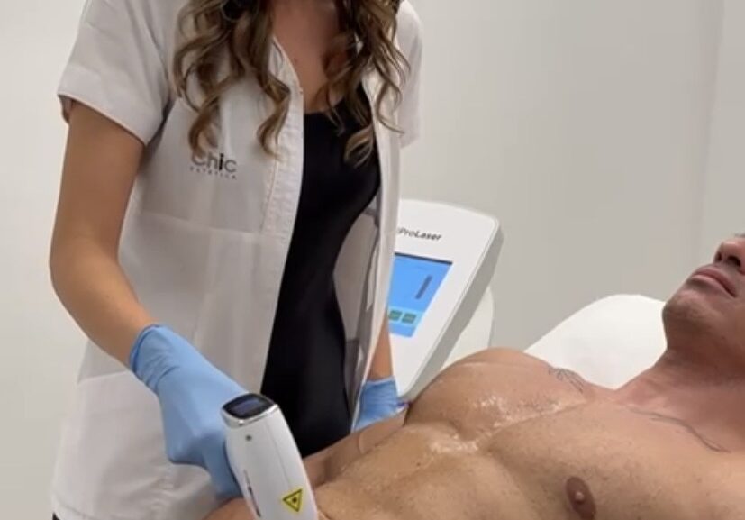 epilazione laser chic estetica epilazione laser chic estetica